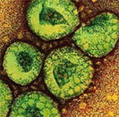 MERS-CoV virus is less likely to spread into epidemics