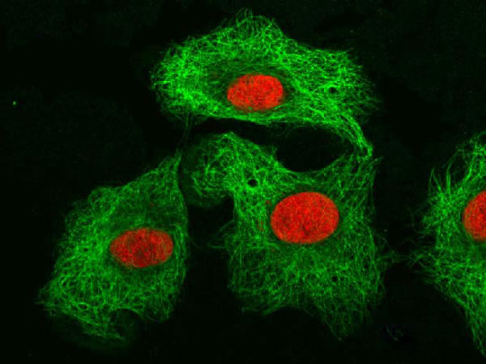 Method of destroying cancer cells by temperature