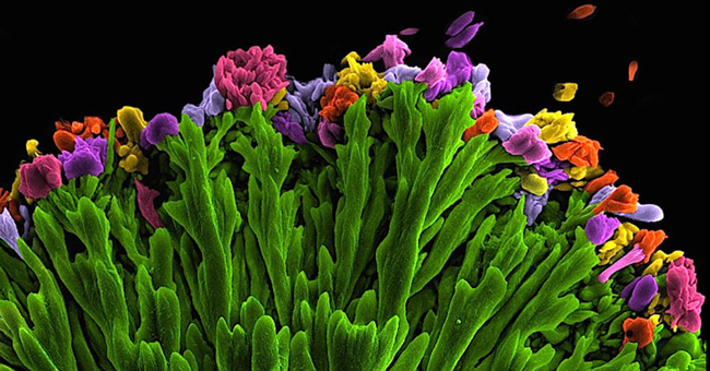 Microbiology world through microscopy