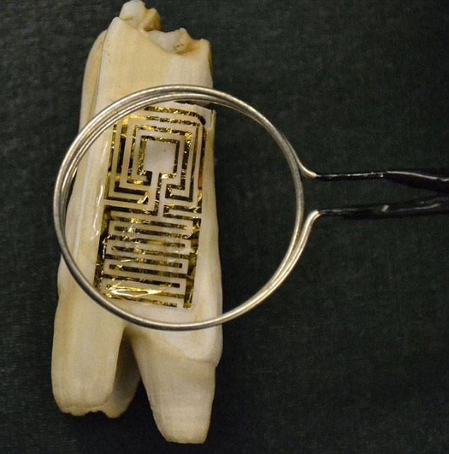 Microelectronic sensor on dental diagnosis