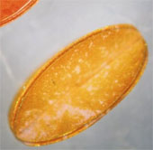 Micro-robots protect the retina
