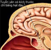 'Millions of people suffer' like Wanbi Tuan Anh in the world