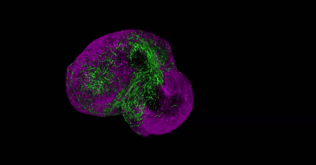 Mini human brain culture to test hallucinogens