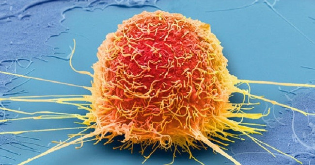 Miracle diet: Starve cancer tumors like soldiers