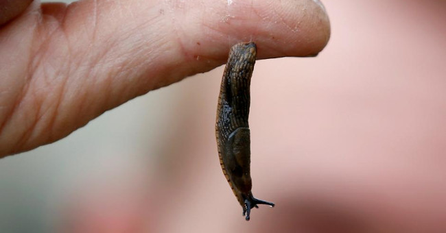 Miraculous glue can 'patch' open wounds