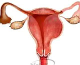 Miscarriage and prevention