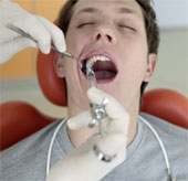 Mistakes about wisdom teeth