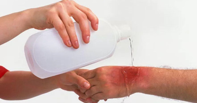 Mistakes to avoid when first aid victims of acidosis