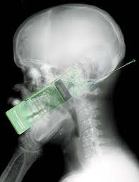 Mobile phones and cancer