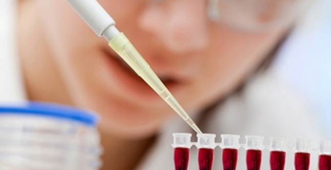 Molecular detection helps extract stem cells for blood cancer treatment