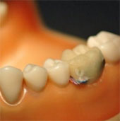 Monitor dental activity with bluetooth