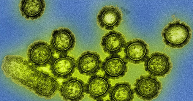More and more viruses are dying around the world, and the reason is not pleasant at all