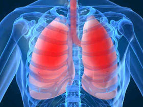 More than 1 million children die from pneumonia each year