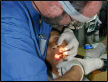 More than 75% of Vietnamese people aged 18-34 years have tooth decay