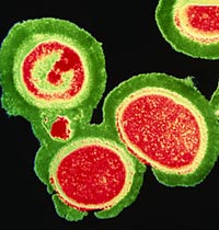 MRSA is more dangerous than HIV