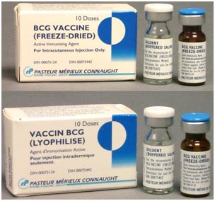 MVA85A: New vaccine against TB