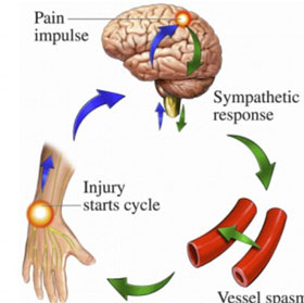 Mysterious syndrome causes more pain than labor