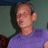 Mystical hemostasis of Nung people