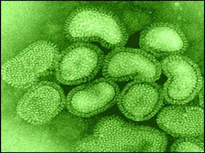 NASA makes biometric sensor for bacterial detection