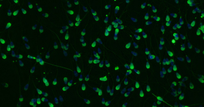 NASA sends ... sperm to ISS space station