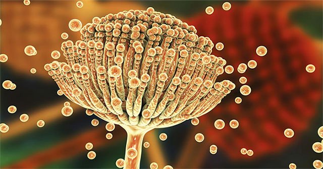 Nearly 15,000 Vietnamese suffer from lung fungus each year