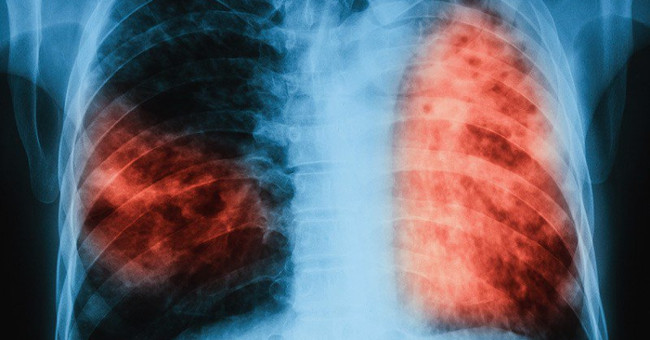 Nearly a quarter of the world's population is at risk of catching this dreaded disease