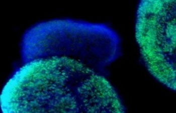 Nerve cell regeneration of mental patients