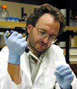 Nervous system disorder is the cause of type 1 diabetes?