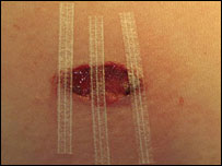 New artificial skin
