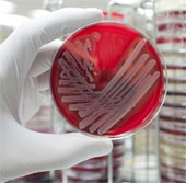 New breakthrough in the fight against drug resistance