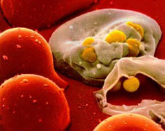 New breakthrough to cure AIDS