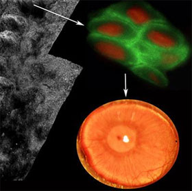 New breakthroughs help blind people see their eyes