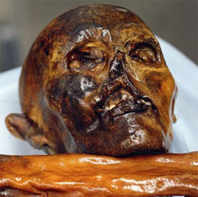 New cause of the death of the Otzi gang