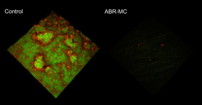 New dental materials help prevent plaque, kill bacteria