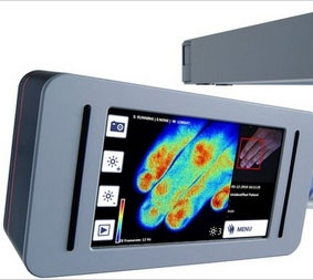 New device for blood flow measurement for burn patients