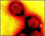 New discovery: Obesity due to ... virus!