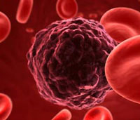 New discovery of genes related to blood cancer