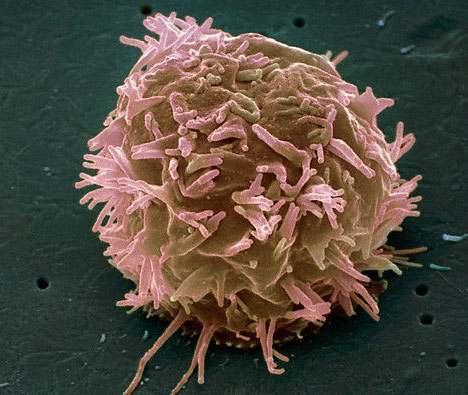 New discovery of metastatic mechanism of cancer cells