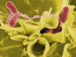New drug resistant virus in cow's milk and humans