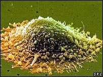 New drugs Asentar treat prostate cancer