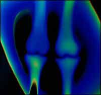 New hope for osteoporosis patients