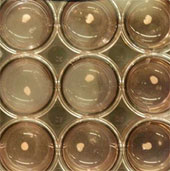 New hope for patients with liver failure