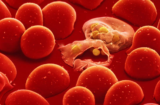 New hope for patients with Mediterranean anemia