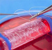 New hope for penile regeneration in humans