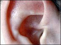 New Implant techniques help deaf people hear clearly