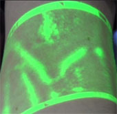 New infrared device makes it easier to detect veins