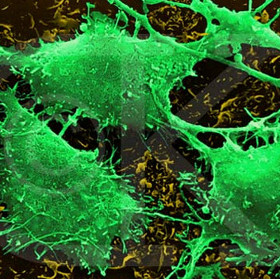 New invention on vaccine kills cancer cells