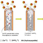 New materials protect sensitive teeth for a long time