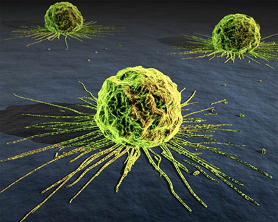New mathematical model against cancer