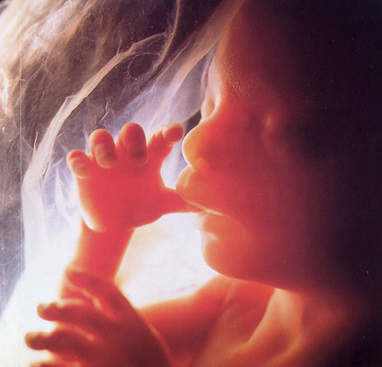 New measures to diagnose Down syndrome in the fetus